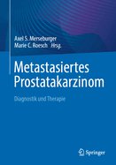 Metastasiertes Prostatakarzinom: Diagnostik Und Therapie