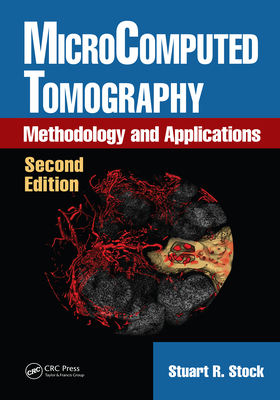 MicroComputed Tomography: Methodology and Applications, Second Edition - Stock, Stuart R.