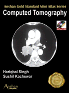 Mini Atlas Computed Tomography