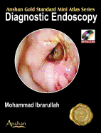 Mini Atlas of Diagnostic Endoscopy