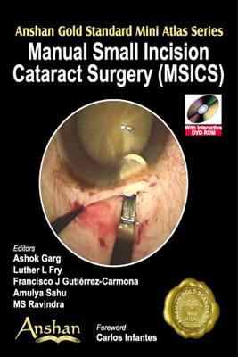 Mini Atlas of Manual Small Incision Cataract Surgery - Garg, Ashok (Editor), and Gutierrez-Carmona, Francisco J (Editor), and Fry, Luther L. (Editor)