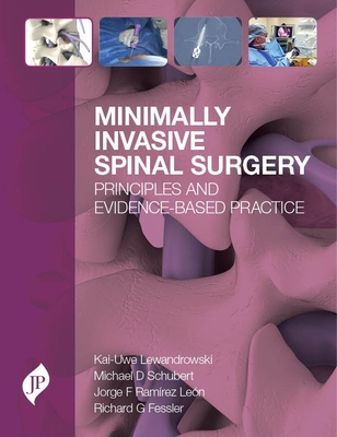 Minimally Invasive Spinal Surgery: Principles and Evidence-Based Practice - Lewandrowski, Kai-Uwe, and Schubert, Michael, and Ramrez Lon, Jorge F