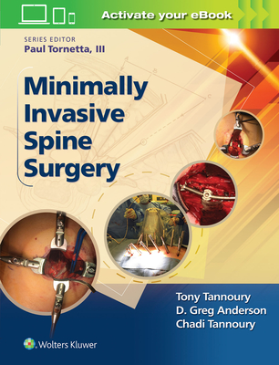 Minimally Invasive Spine Surgery - Tannoury, Chadi, Dr.