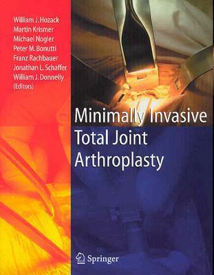 Minimally Invasive Total Joint Arthroplasty - Hozack, William J (Editor), and Krismer, Martin (Editor), and Nogler, Michael (Editor)