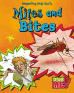 Mites and Bites