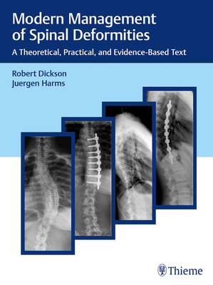 Modern Management of Spinal Deformities: A Theoretical, Practical, and Evidence-Based Text - Dickson, Robert a, and Harms, Jrgen