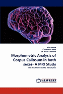 Morphometric Analysis of Corpus Callosum in Both Sexes- A MRI Study