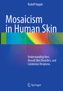 Mosaicism in Human Skin: Understanding Nevi, Nevoid Skin Disorders, and Cutaneous Neoplasia