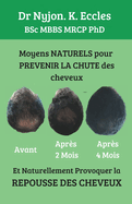 Moyens NATURELS pour Pr?venir la chute des cheveux: Et naturellement provoquer la REPOUSSE DES CHEVEUX