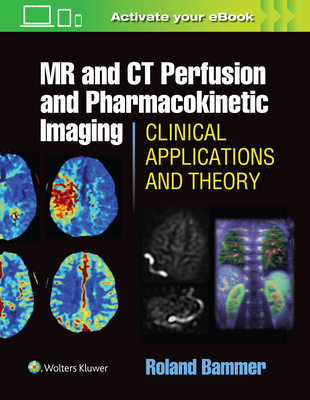 MR and CT Perfusion and Pharmacokinetic Imaging: Clinical Applications and Theoretical Principles - Bammer, Roland