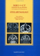 MRI and CT Atlas of Correlative Imaging in Otolaryngology - Flanders, Adam E, and Rao, Vijay M, and Tom, Barry M