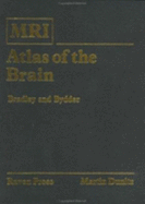 MRI Atlas of the Brain