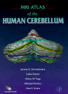 MRI Atlas of the Human Cerebellum - Schmahmann, Jeremy D, and Doyon, Julien, and Petrides, Michael