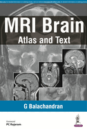 MRI Brain: Atlas and Text