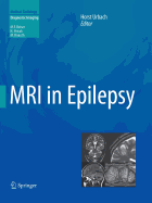 MRI in Epilepsy