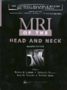 MRI of the Head and Neck - Lufkin, Robert B (Editor), and Borges, Alexandra, MD (Editor), and Nguyen, Kim N, MD (Editor)