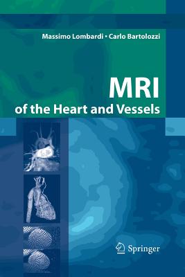 MRI of the Heart and Vessels - Lombardi, Massimo, and Donato, L (Foreword by), and Walker, M (Translated by)