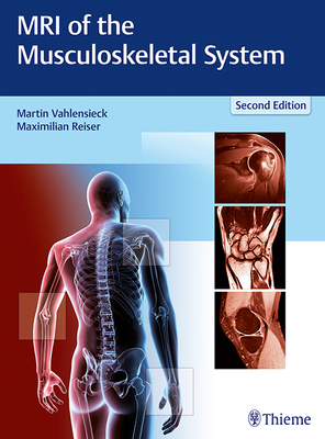 MRI of the Musculoskeletal System - Vahlensieck, Martin (Editor), and Reiser, Maximilian (Editor)