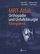 MRT-Atlas Orthopadie Und Unfallchirurgie: Kniegelenk - Teller, Peter, and Hamm, B (Foreword by), and Knig, Hermann