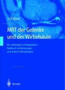 Mrt Der Gelenke Und Der Wirbelsaule: Radiologisch-Orthopadische Diagnostik