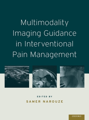 Multimodality Imaging Guidance in Interventional Pain Management - Narouze, Samer N (Editor)