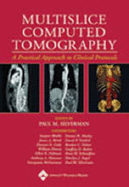 Multislice Computed Tomography: a Practical Approach to Clinical Protools