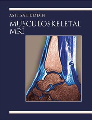 Musculoskeletal MRI: A Rapid Reference Guide - Saifuddin, Asif