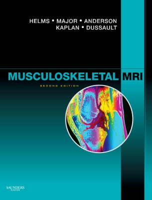 Musculoskeletal MRI - Helms, Clyde A, MD, and Major, Nancy M, MD, and Anderson, Mark W, MD