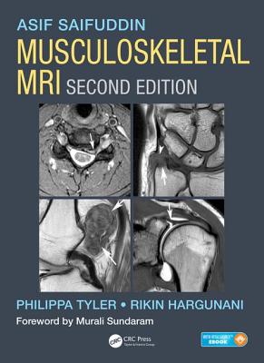 Musculoskeletal MRI - Saifuddin, Asif, and Tyler, Philippa, and Hargunani, Rikin