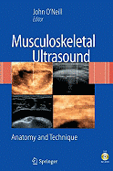 Musculoskeletal Ultrasound: Anatomy and Technique