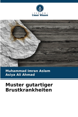 Muster gutartiger Brustkrankheiten - Aslam, Muhammad Imran, and Ahmad, Asiya Ali