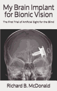 My Brain Implant for Bionic Vision: The First Trial of Artificial Sight for the Blind