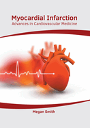 Myocardial Infarction: Advances in Cardiovascular Medicine
