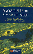 Myocardial Laser Revascularization - Bridges, Charles (Editor), and Horvath, Keith (Editor), and Chiu, Ray Chu-Jeng (Editor)