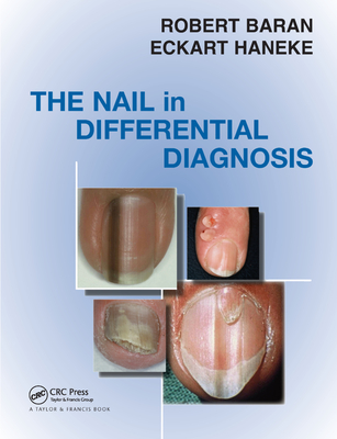 Nail in Differential Diagnosis - Baran, Robert, and Haneke, Eckart