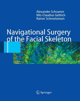 Navigational Surgery of the Facial Skeleton - Schramm, Alexander, and Gellrich, Nils-Claudius, and Schmelzeisen, Rainer