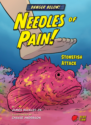 Needles of Pain!: Stonefish Attack - Buckley James Jr