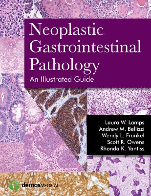 Neoplastic Gastrointestinal Pathology: An Illustrated Guide: An Illustrated Guide - Lamps, Laura, MD, and Bellizzi, Andrew, MD, and Frankel, Wendy L, MD