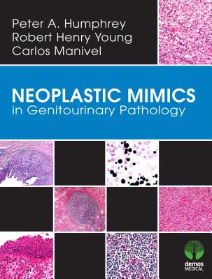 Neoplastic Mimics in Genitourinary Pathology - Humphrey, Peter, MD, and Manivel, J Carlos, MD, and Young, Robert, MD