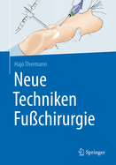 Neue Techniken Fuchirurgie