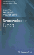 Neuroendocrine Tumors