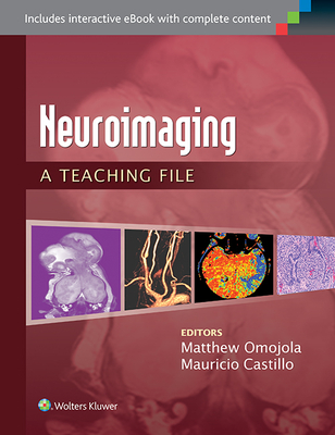 Neuroimaging: A Teaching File: A Teaching File - Omojola, Matthew, and Castillo, Mauricio, MD
