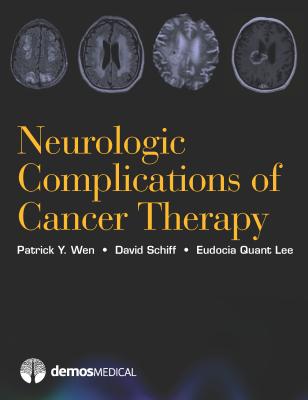 Neurologic Complications of Cancer Therapy - Wen, Patrick Y, MD, and Schiff, David, MD, and Quant Lee, Eudocia, MD, MPH