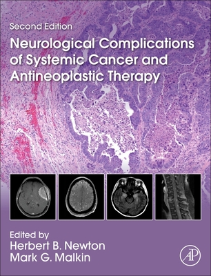 Neurological Complications of Systemic Cancer and Antineoplastic Therapy - Newton, Herbert B (Editor), and Malkin, Mark G (Editor)