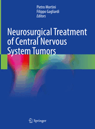 Neurosurgical Treatment of Central Nervous System Tumors