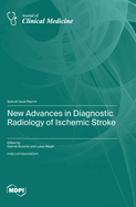 New Advances in Diagnostic Radiology of Ischemic Stroke