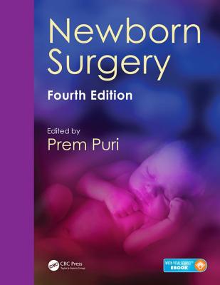 Newborn Surgery - Puri, Prem (Editor)