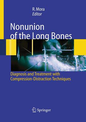 Nonunion of the Long Bones: Diagnosis and Treatment with Compression-Distraction Techniques - Mora, Redento (Editor), and Paley, D (Foreword by)