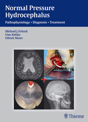 Normal Pressure Hydrocephalus: Pathophysiology - Diagnosis - Treatment - Fritsch, Michael J, and Kehler, Uwe, and Meier, Ullrich