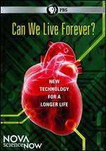 NOVA scienceNOW: Can We Live Forever?